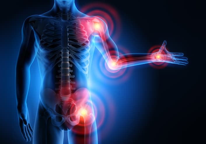 Joint & Muscle Issues