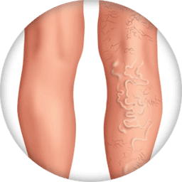 Visible Veins