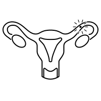Ovulatory