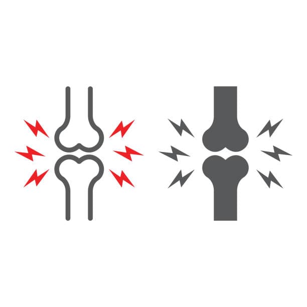 Joint Abnormalities/Malformation