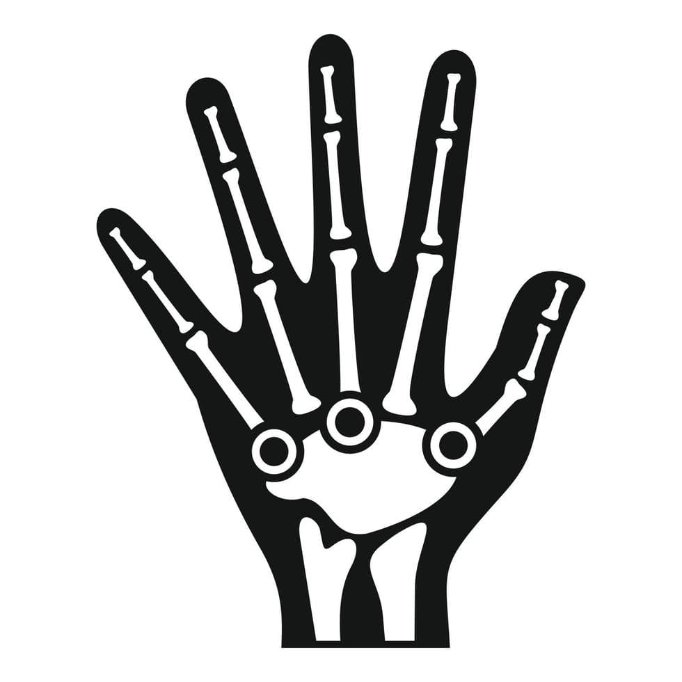 Hand Symptoms