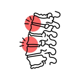 Spine Symptoms